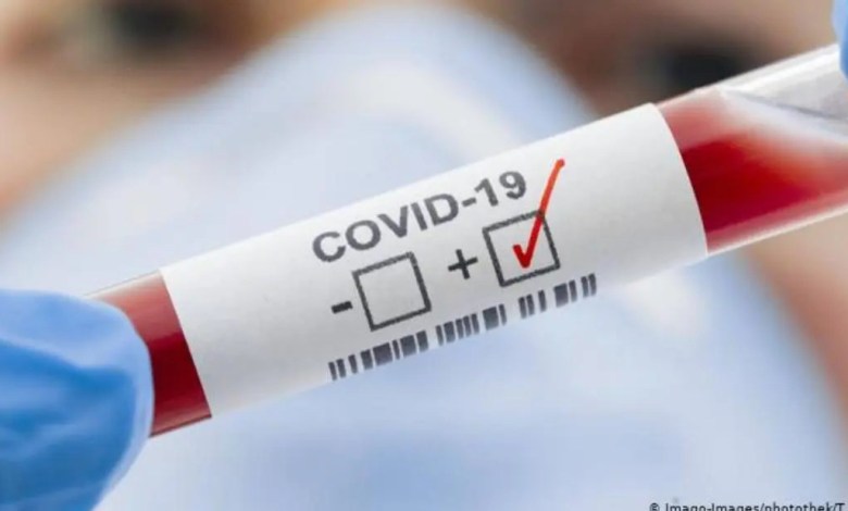 Covid-19: des chercheurs disent avoir découvert un premier cas de réinfection